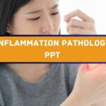 Inflammation Pathology PPT images